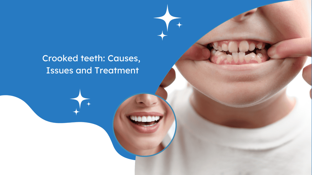 treatment for crooked teeth